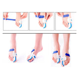 Orthopedic Bunion Corrector Wear While Sleeping (1 Pair) - ModernKitchenMaker.com